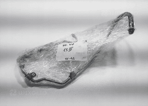 Przewód wspomagania citroen C5 iii X7 2.0 hdi 9672533680 2008-2011 europa 7
